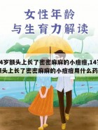 14岁额头上长了密密麻麻的小痘痘,14岁额头上长了密密麻麻的小痘痘用什么药